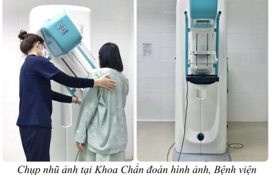 Chụp nhũ ảnh tầm soát Ung thư vú tại Bệnh viện Sản nhi tỉnh